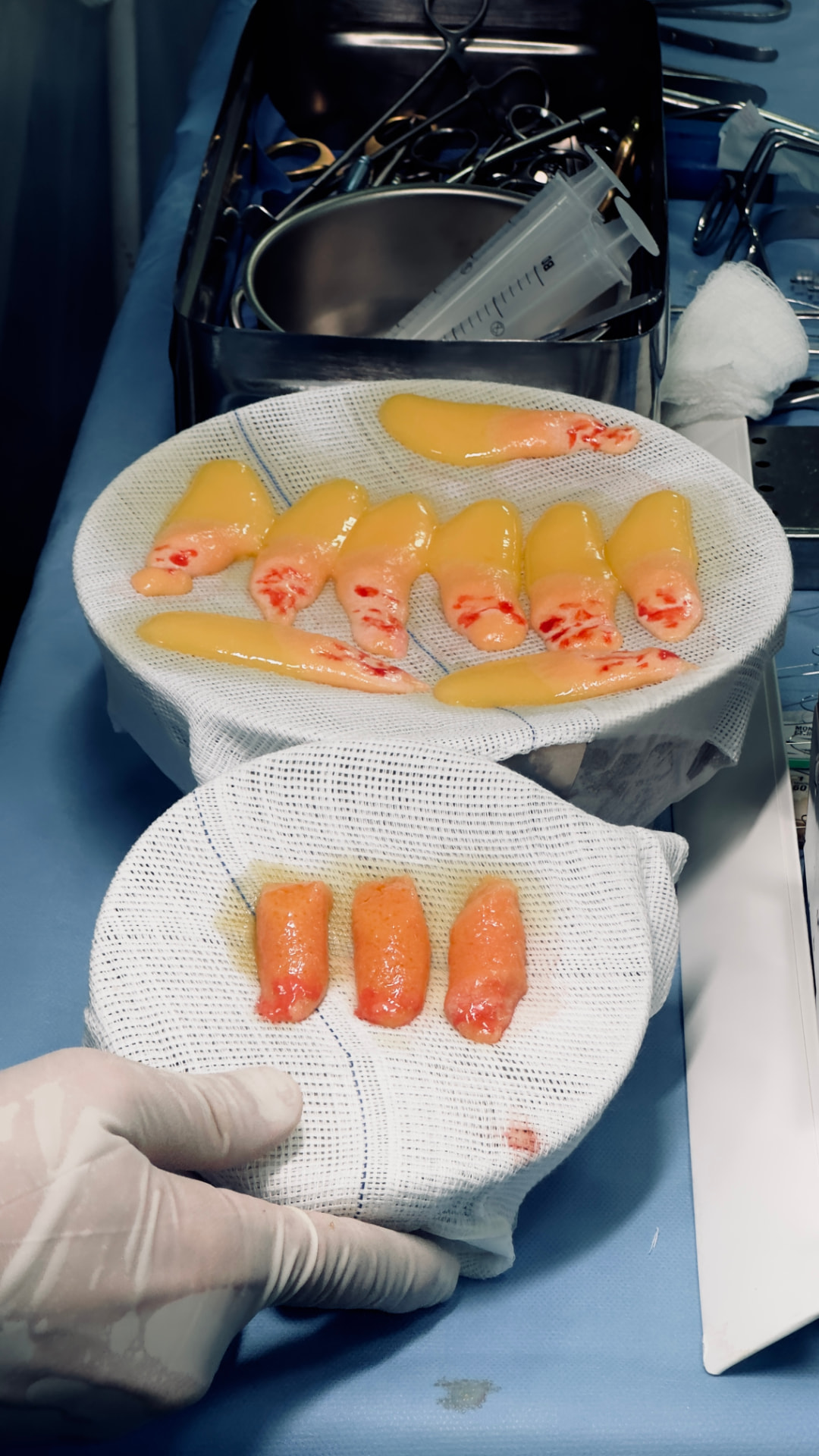 Frações do tecido adiposo processado