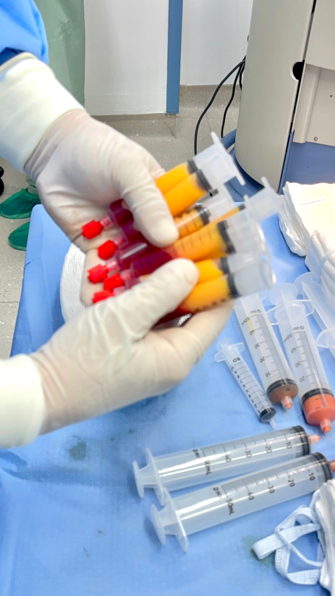 Seringas com o tecido adiposo processado